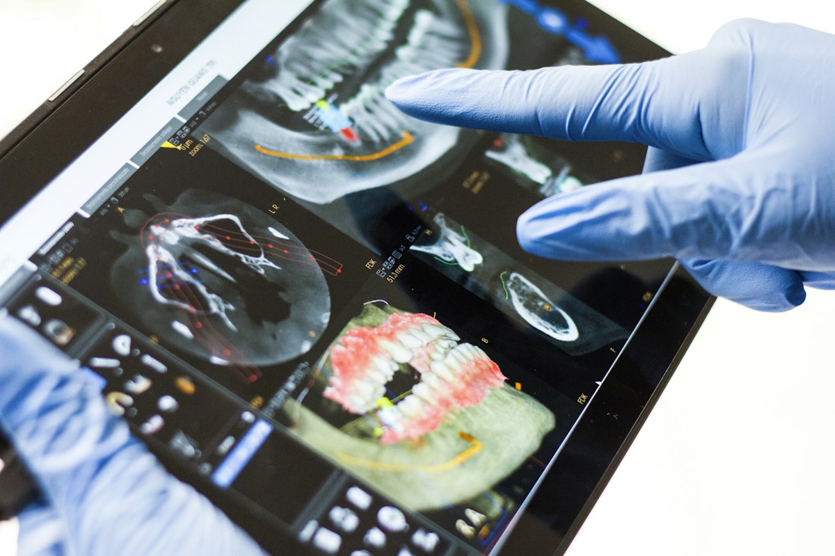 Tablette dijital diş taraması